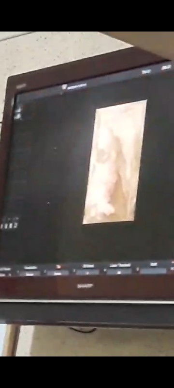 Arti sesungguhnya ketika bumil banyak pikiran dan sedih nyata janinpun raut wajahnya seperti sedih