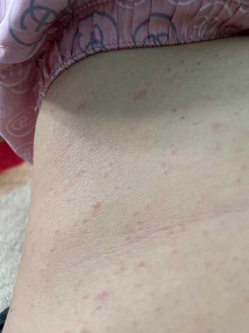 Lo lắng của mẹ bầu