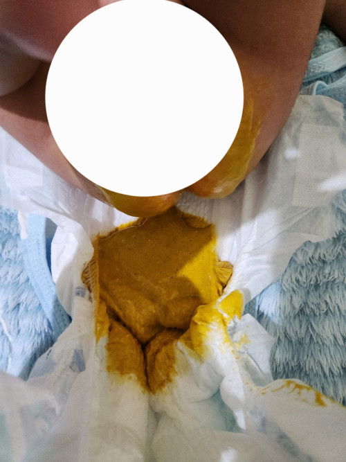 Bayi 2bulan bab tbtb cair