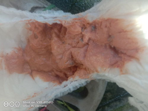 อุจจาระเป็นสีส้ม ปกติไหมคะ เป็นครั้งแรกที่เห็นเพราะตลอดจะออกเป็นสีเหลืองกับเขียว ลูกกินนมผงคะ