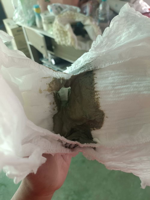 เด็ก 4 เดือน ถ่ายเป็นแบบนี้ ปกติไหม ค่ะ น้องกินนมชง