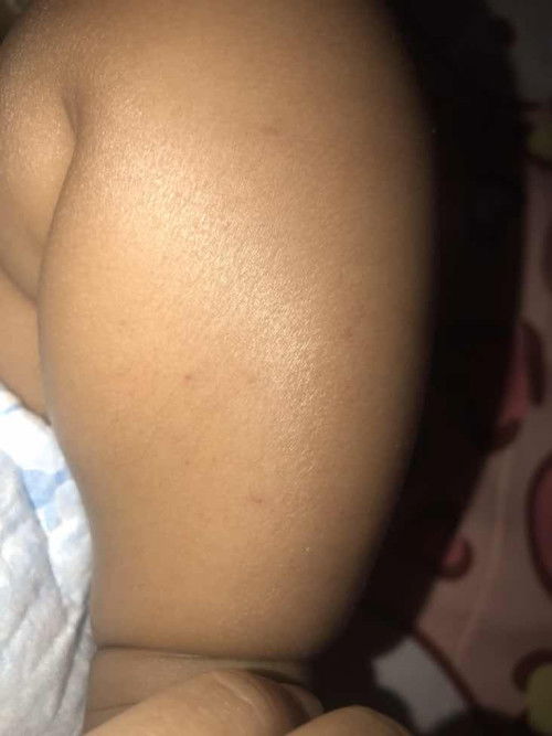 เป็นจุดแดงแบบนี้อันตรายรึป่าวคะ