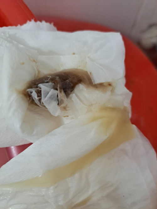 Bong nút nhầy tuần 40