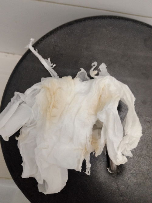 ตกขาวสีเหลือง