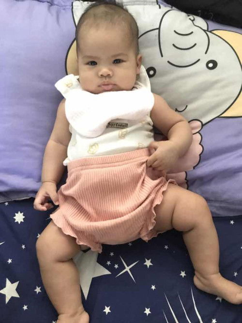 ลูกร้องแต่ไม่ใช่โคลิค