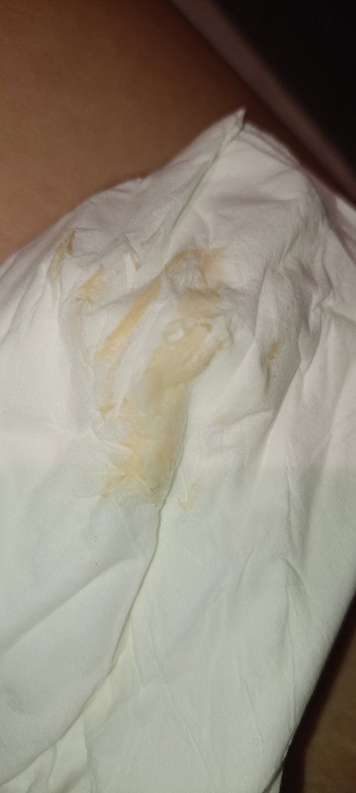 มีแม่ๆคนไหนตกขาวสีนี้บ้างคะ