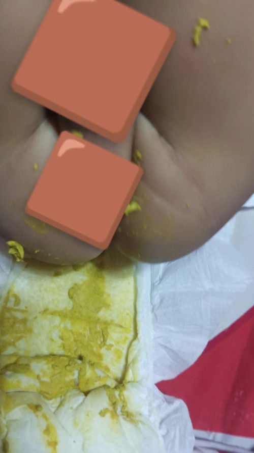 PASINTABI PO SA MGA KAKAEN OR KUMAKAEN.
NORMAL PO BA ITONG POOPS NG ANAK KO? 7MOS BABY BOY