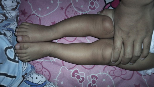 แบบนี้เรียกโก่งไหมคะ