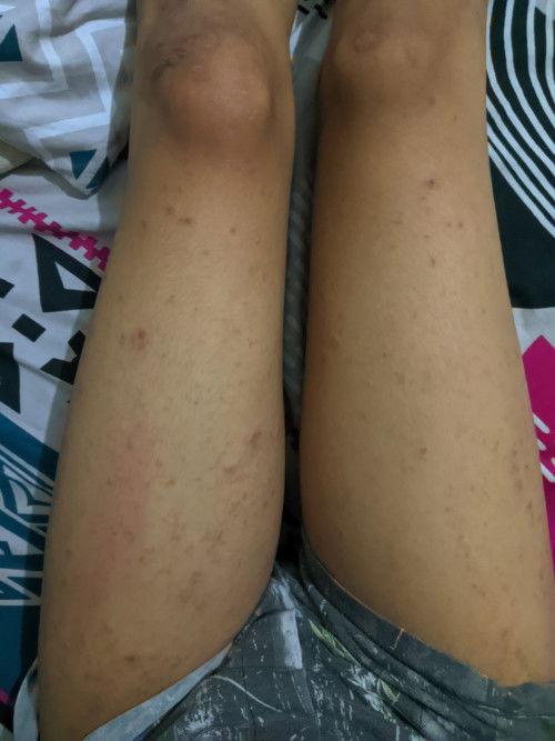 izin bertanya ya bun yg jijik skip aja🙏