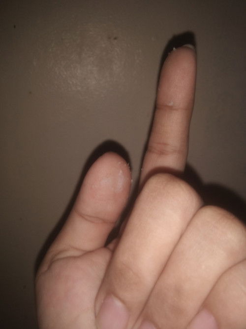 Going 35 weeks Discharge.....