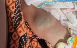 Bayi lahir usia 3 hari