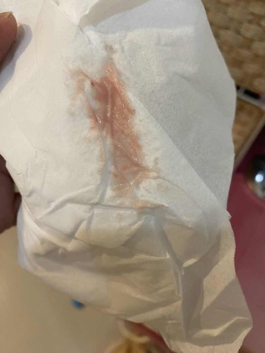 35 วีค 1 วัน