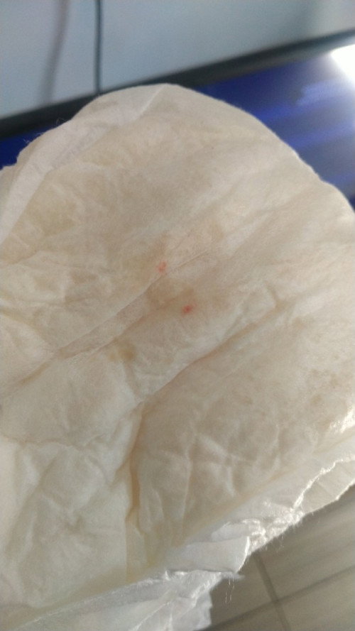 Apakah ada masalah di urine nya