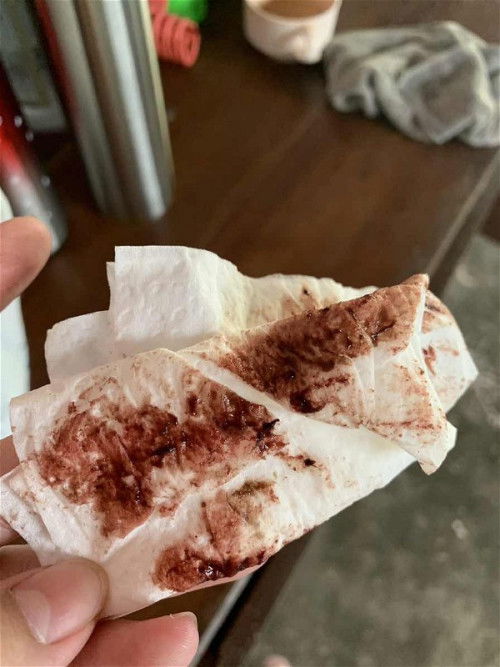 มีเลือดออก ตกขาวปนเลือด