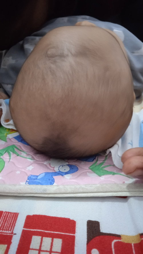 Kepala bayi yang benar