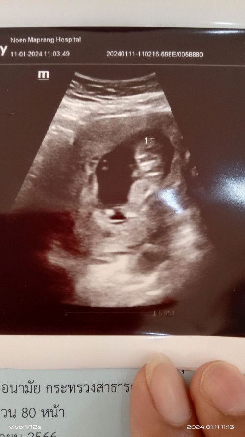 วันนี้ได้เจอน้องแล้ว🥰