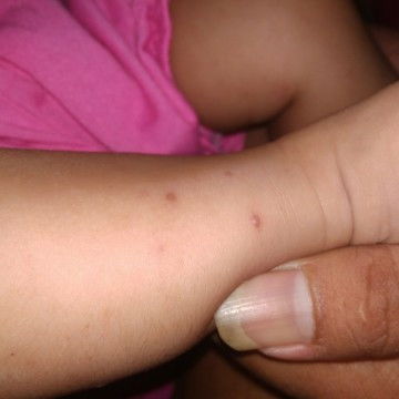 Ada yang sama nggak bun bayinya keluar kek gini.? Kira" dikasih obat apa yah.?