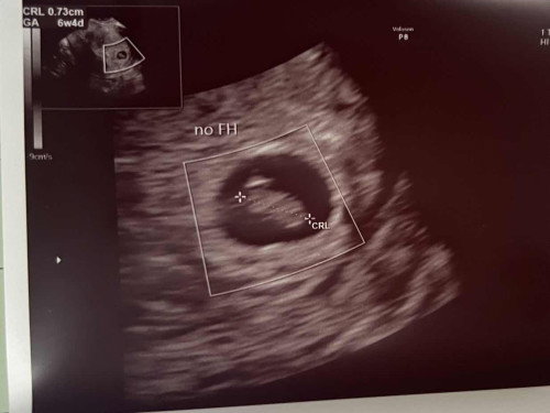 No heartbeat 😢