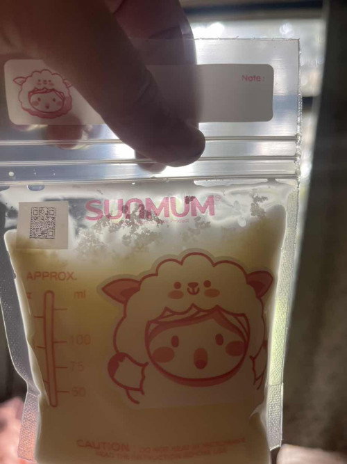 นมแม่เป็นแบบนี้ผิดปกติไหม