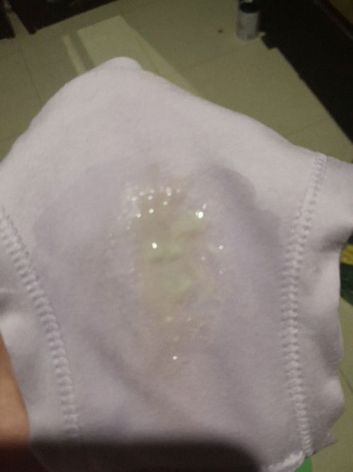 Mình bị ra như này thì có phải sắp  sinh ko a