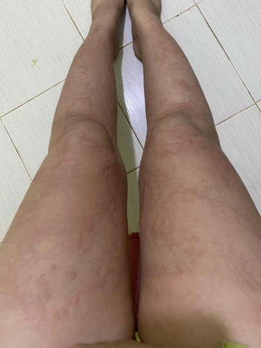 มีแม่ๆท่านไหนมีประสบการณ์แบบนี้ไหมค่ะ