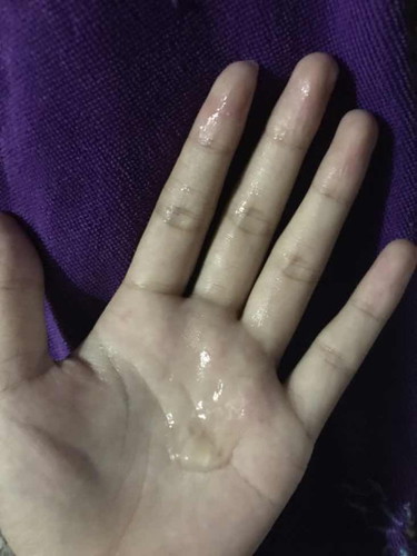 เเบบนี้ต้องไปโรงพยาบาลมั้ยค่ะ ท้อง 39+5 w