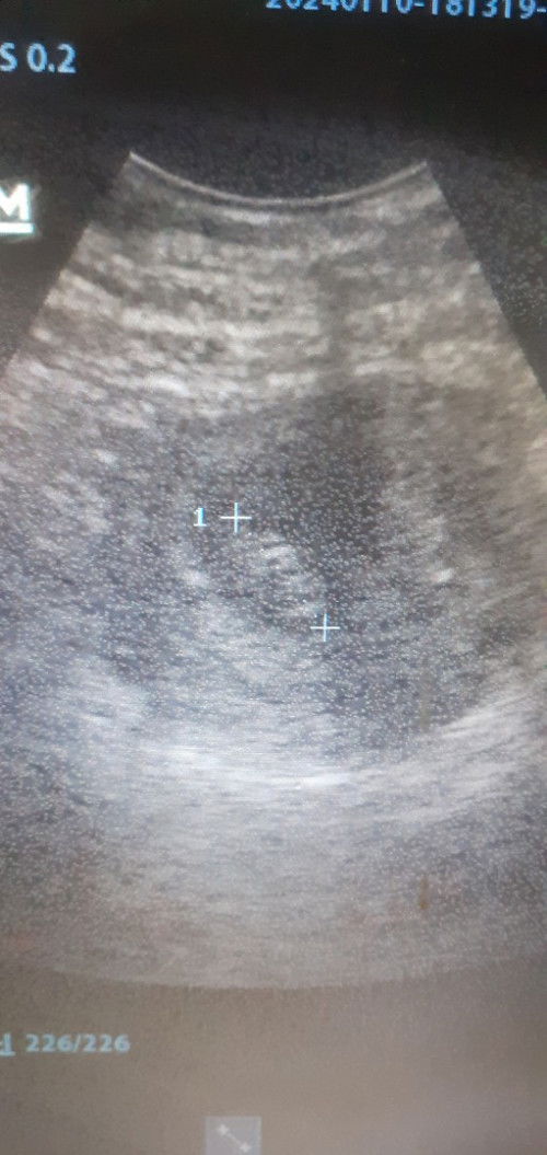 Usia hpht sama usg beda