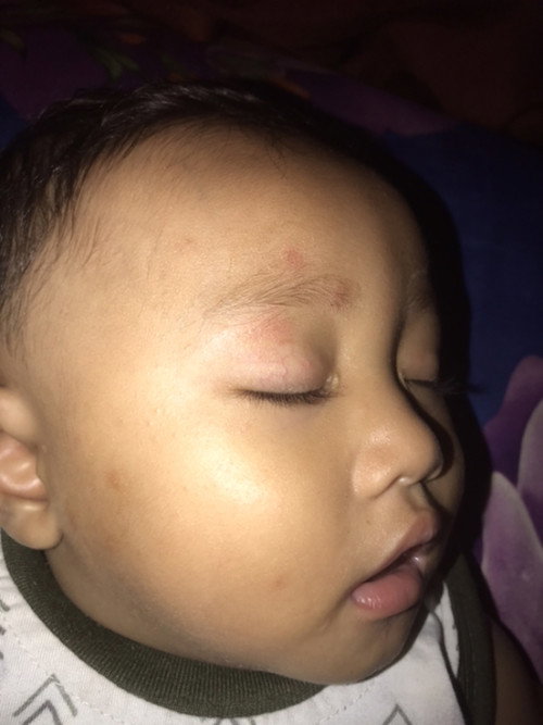 Obat/salep yang bagus