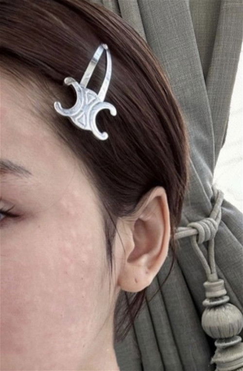 Alergi trimester 3 hpl July