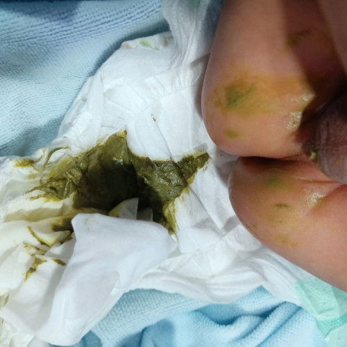 ถ่ายเขียว เหนียว