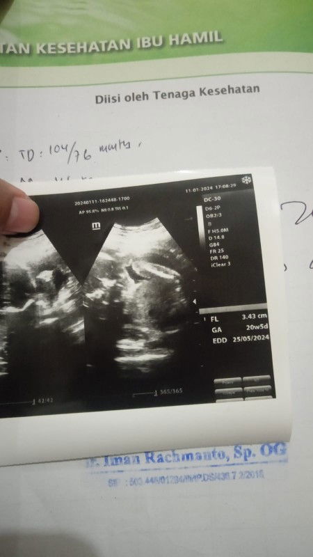 cara membaca hasil usg