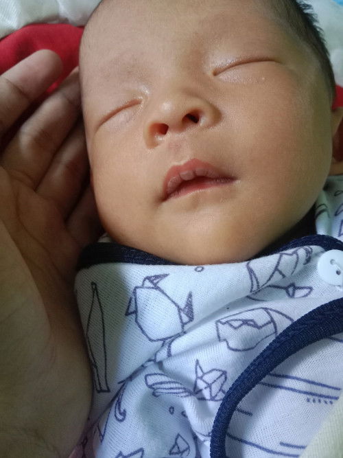 Ada yang tau knp bibir anak ku begini apa karena dot yaa bun?