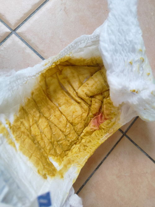 Nak tanya adakah ini darah