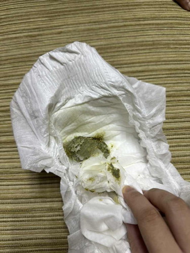 Tahi hijau keras