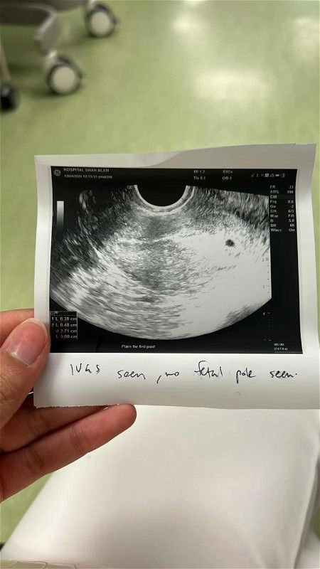 Scan diusia 5W sbb spotting