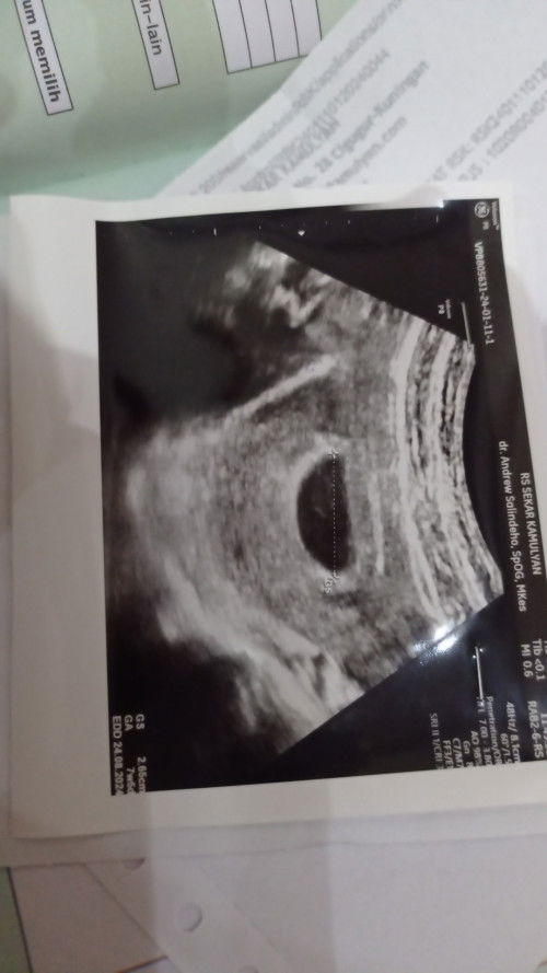 DOKTER VONIS HAMIL BO