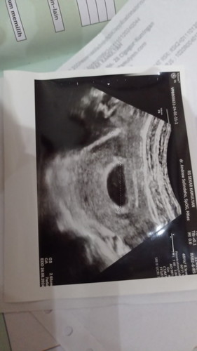 DOKTER VONIS HAMIL BO