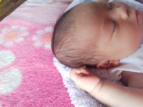 หัวลูกบวมค่ะ