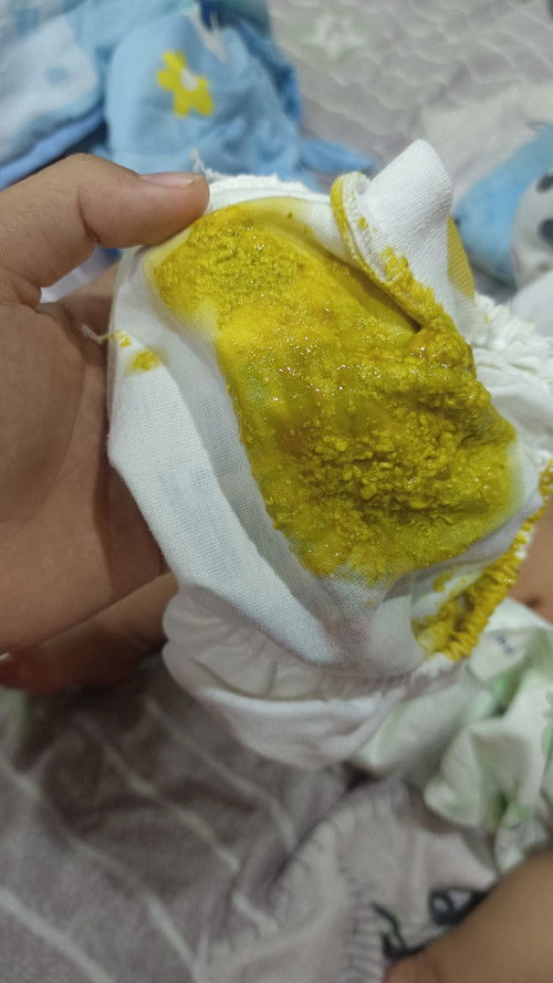 สีอุจจาระลูกน้อย