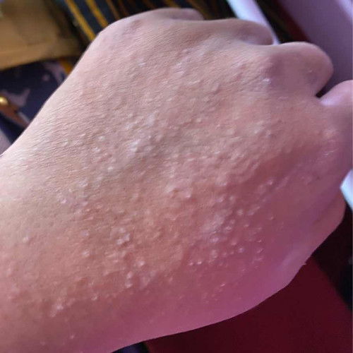 gatal di tm 3 sharing ya moms kalo ada yg tau mohon di komen🙏🏼