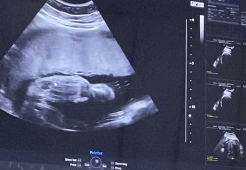 moms ini Jk cewe kan ya?