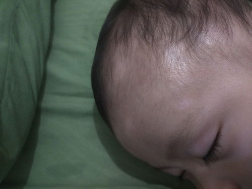 Bintik putih pada muka bayi 7 bulan