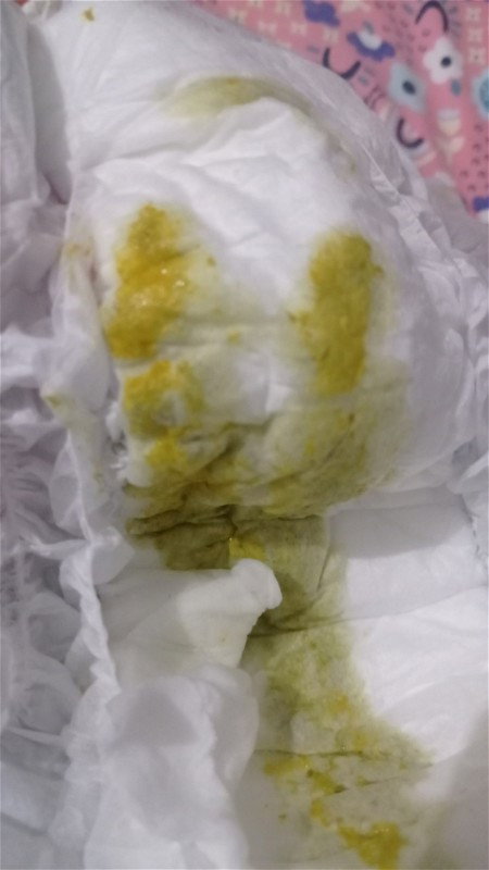 BAB bayi normal atau tidak?