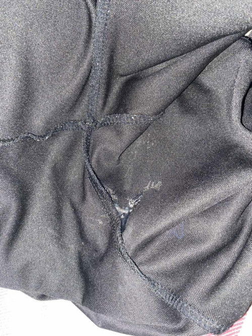 มีมูกใสแบบนี้ต้องไปหาหมอไหมค่ะ