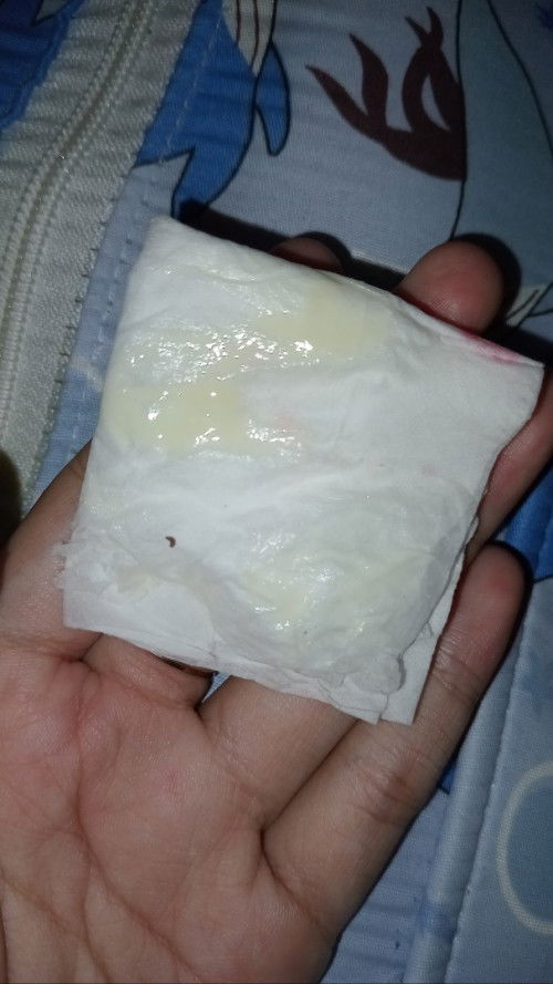 Keputihan atau ketuban