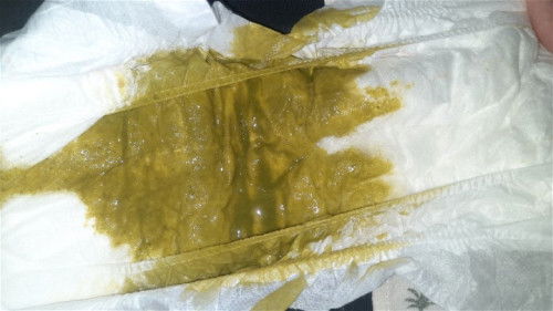 Bab bayi usia 2 bulan