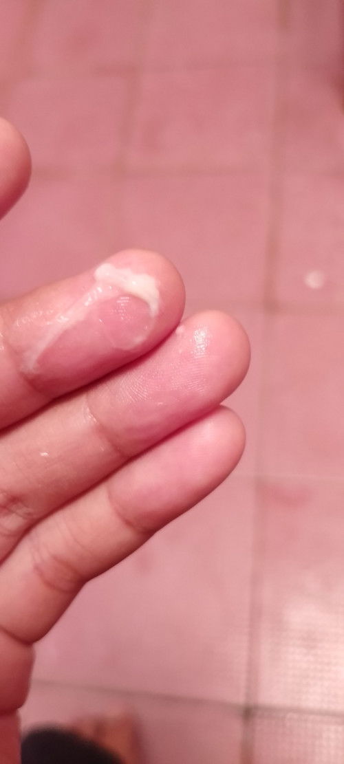 Apakah normal keputihan?