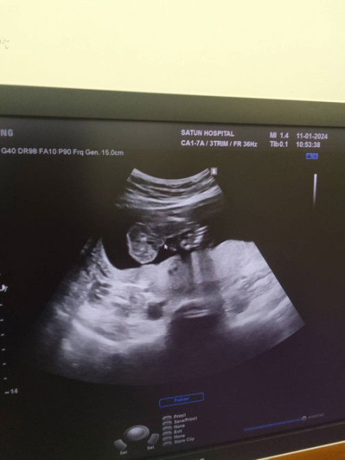 แม่ๆช่วยดูให้หน่อยค่ะ