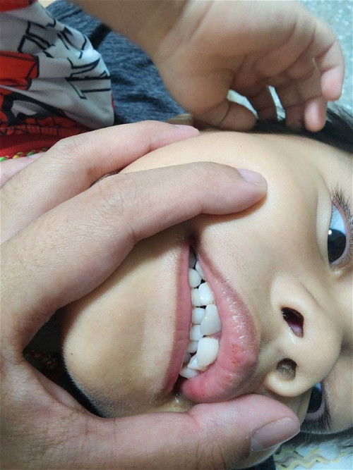 สอบถามเรื่องฟันค่ะ