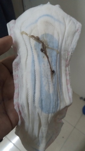Salam nak tanya apakah tanda ini ya momy2 semua , saya pregnt dh 9mnggu ..